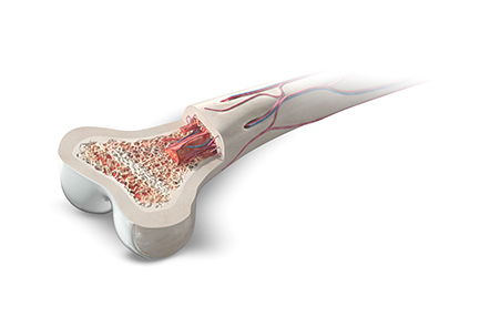무릎줄기세포 치료 장점 부작용 없음